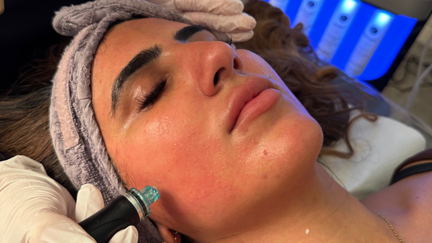 What is a HydraFacial Treatment?