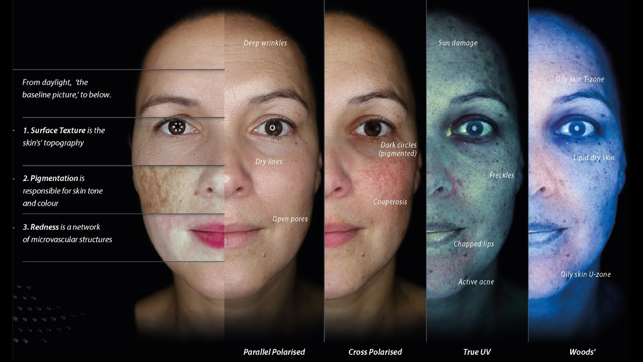 Skin Analysis and Consultation images