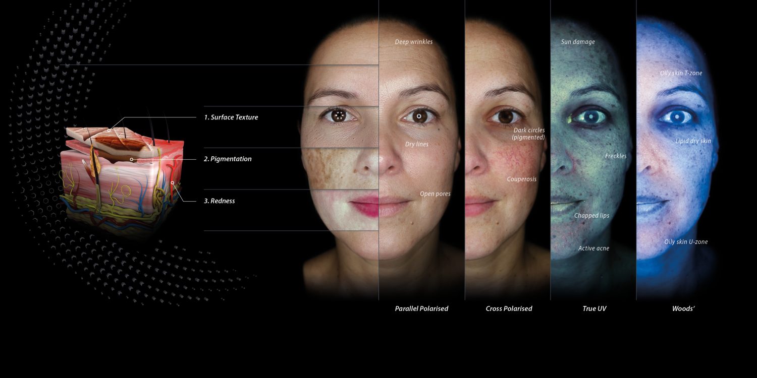 Examples of Skin Review Consultation Photos